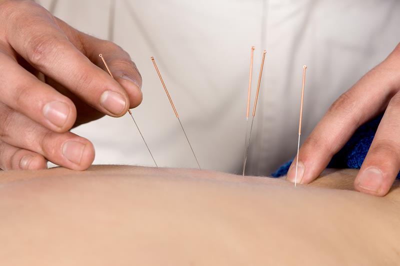 Acupuncture  Menifee, CA 